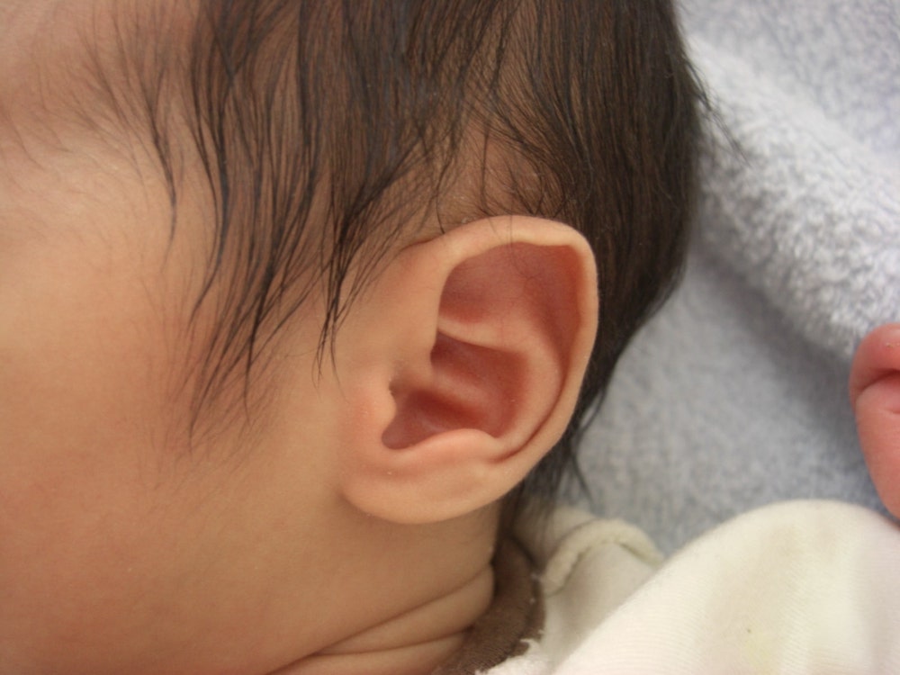 赤ちゃんの中耳炎は風邪が原因 赤ちゃん成長ナビ 小児科専門医師 監修