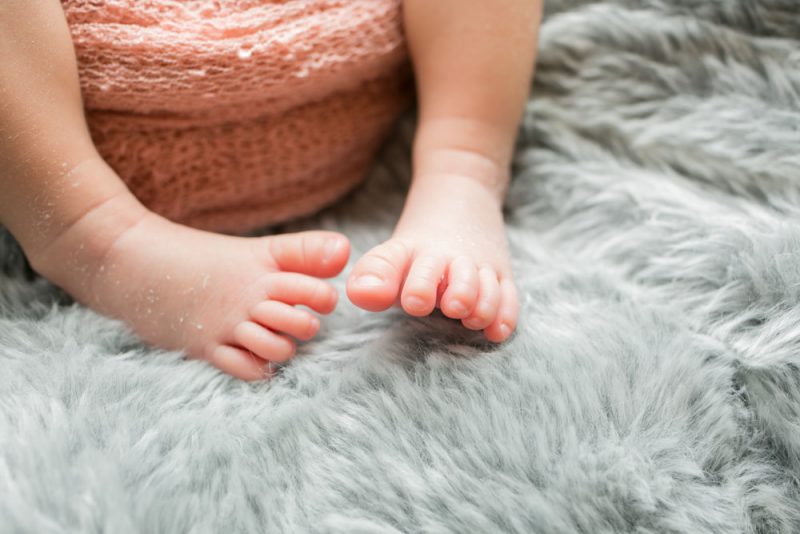 赤ちゃんの黄疸の種類と治療