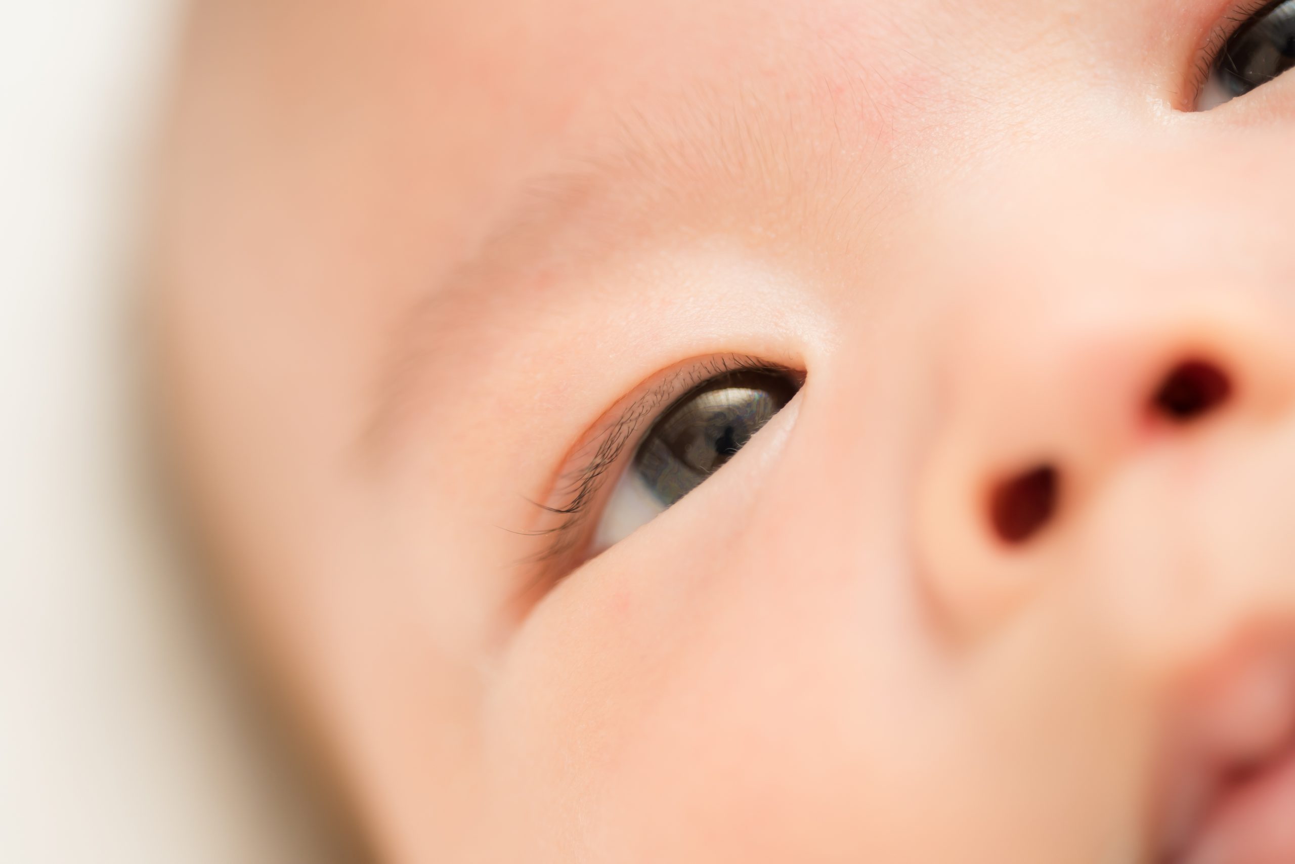 赤ちゃんの目の腫れの原因と対処法 赤ちゃん成長ナビ 小児科専門医師 監修